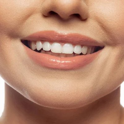 SOIN DES DENTS