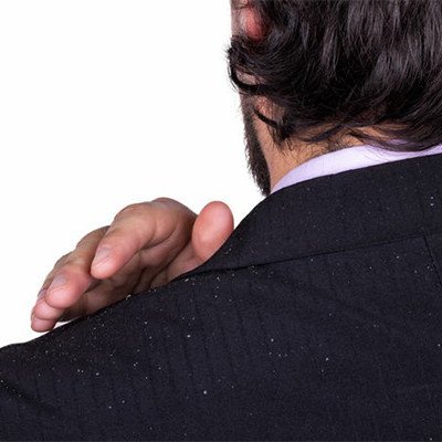 شامبو ضد القشرة